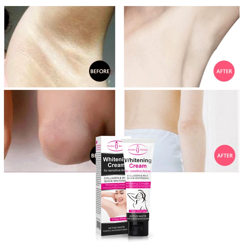 

Aichun Underarm whitening Brighten Cream Repair Lighten melanin remove dead skin Whitening Accelerate melanin metabolism care
