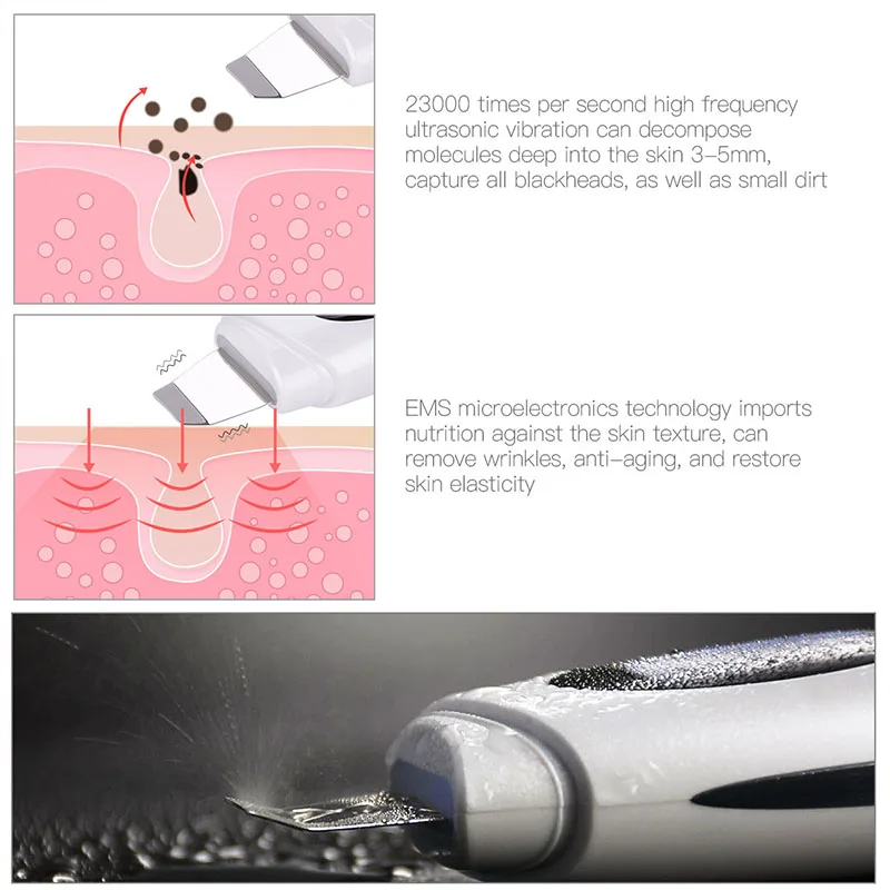 Ультразвуковая Гальваническая ионная EMS подтягивающая скруббер пилинг для кожи очиститель пор отбеливающий отшелушивающий крем для лица для удаления угрей