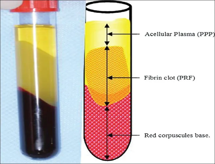 PRF
