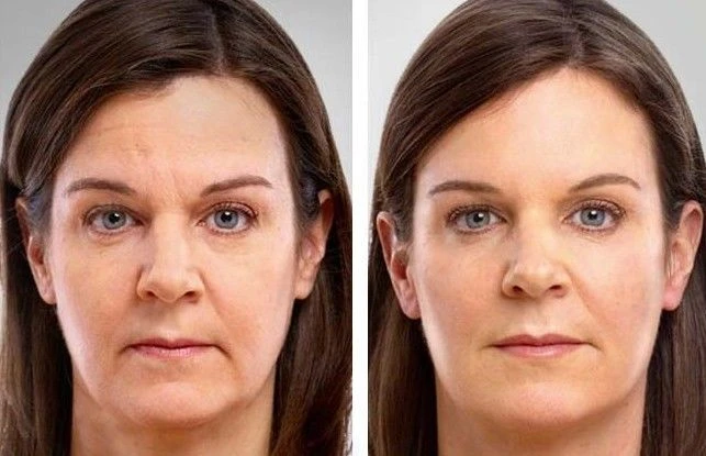 alpha lipoic acid face serum