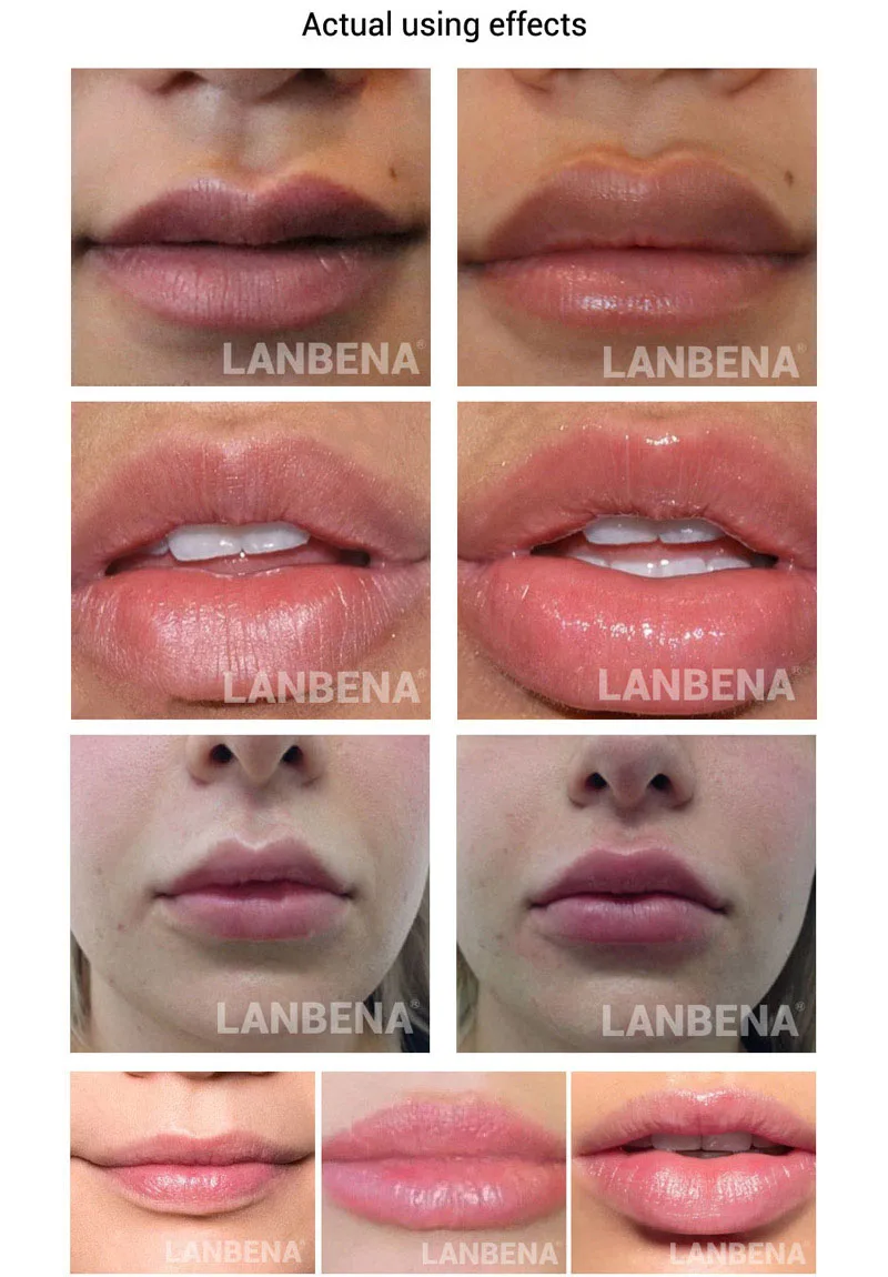 Lip-care-serum-5_02