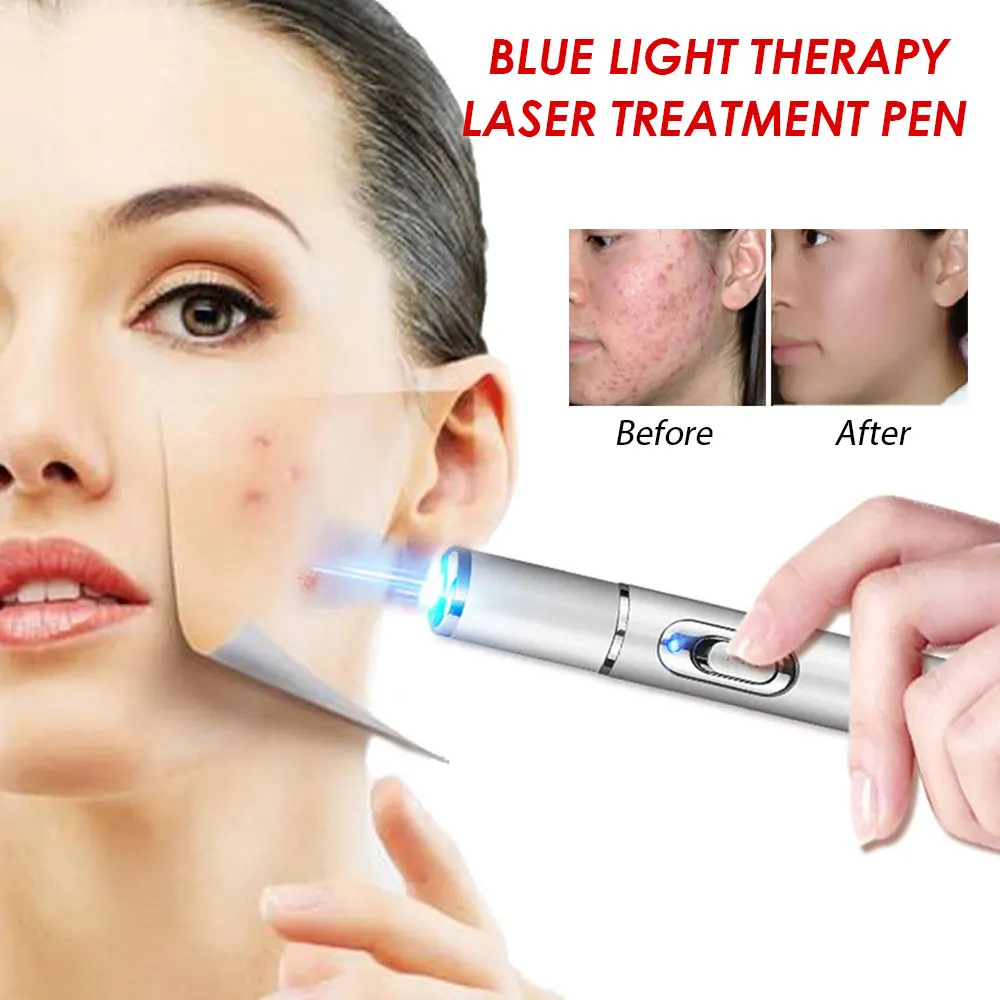 Personal Care Facial Beauty Device Portable Blue Light Gift Acne Pen Cosmetic White Scar Wrinkle Removal Anti-Aging