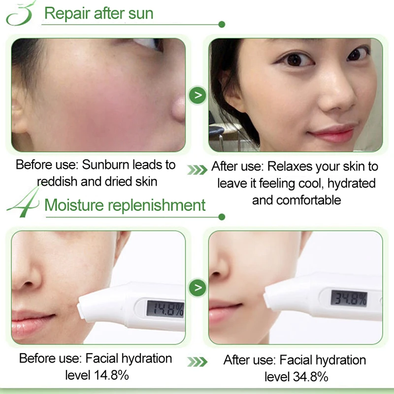 OneSpring Aloe vera gel face cream Anti Acne Anti-sensitive Oil-control Repair after-sun moisturizer relieving itching skin care OneSpring Aloe vera gel face cream Anti Acne Anti-sensitive Oil-control Repair after-sun moisturizer relieving itching skin care