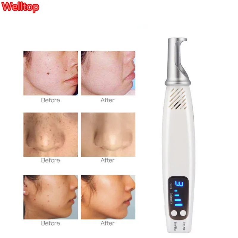 Picosecond レーザーペン Handheald ブルーレイ Picosecond ペン傷跡タトゥー除去メラニンを希釈装置充電式スポット消しゴム