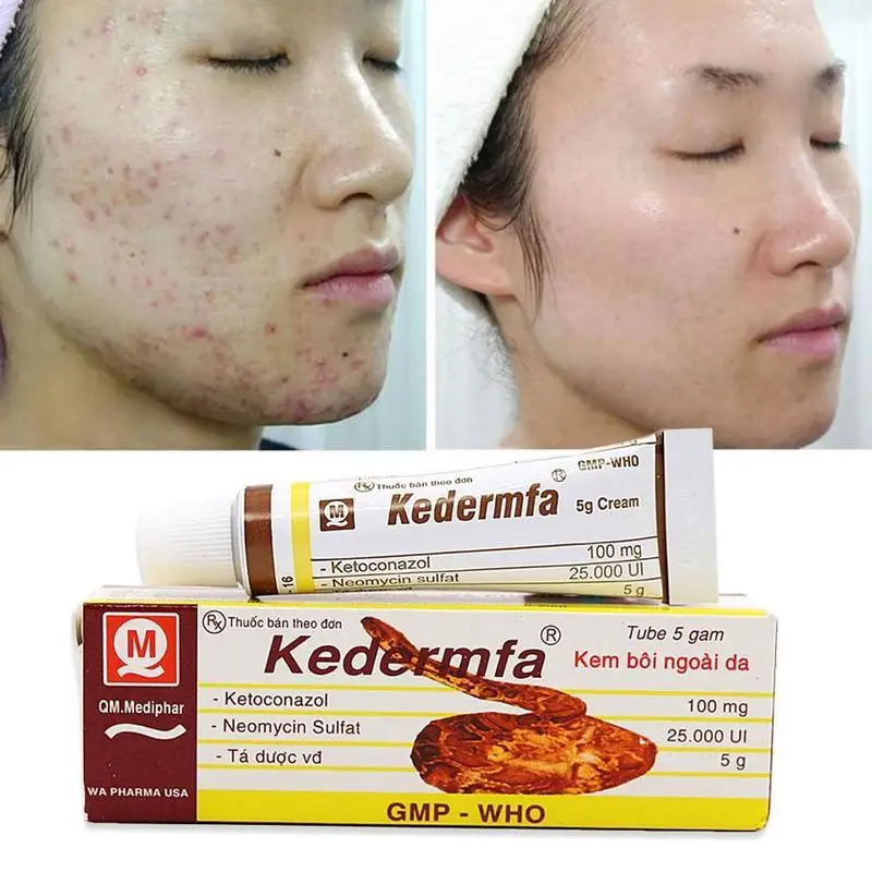 

5g Vietnam Original Snake oil Hand Skin Face Care Cream Snake Balm ointment Tube Nourishing Skin Moisture Body Dropship