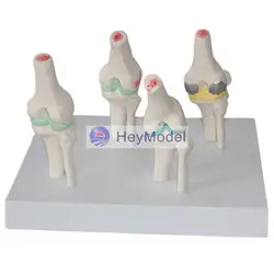 HeyModel наколенник патологическая сцена изменения демонстрационная модель