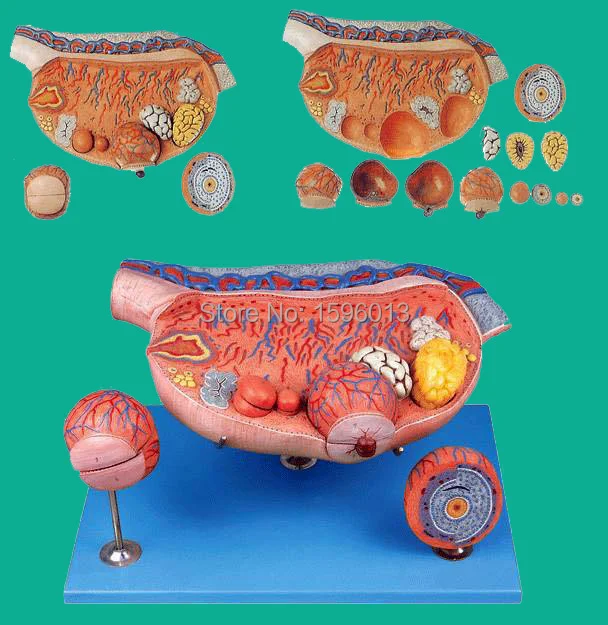 Enlarged Ovary model,Human Ovary model, Model of human ovarianin