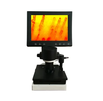 

2017 New Nail fold capillary microcirculation analysis instruments