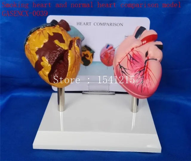 Human heart model Medical teaching model Smoking heart and normal heart