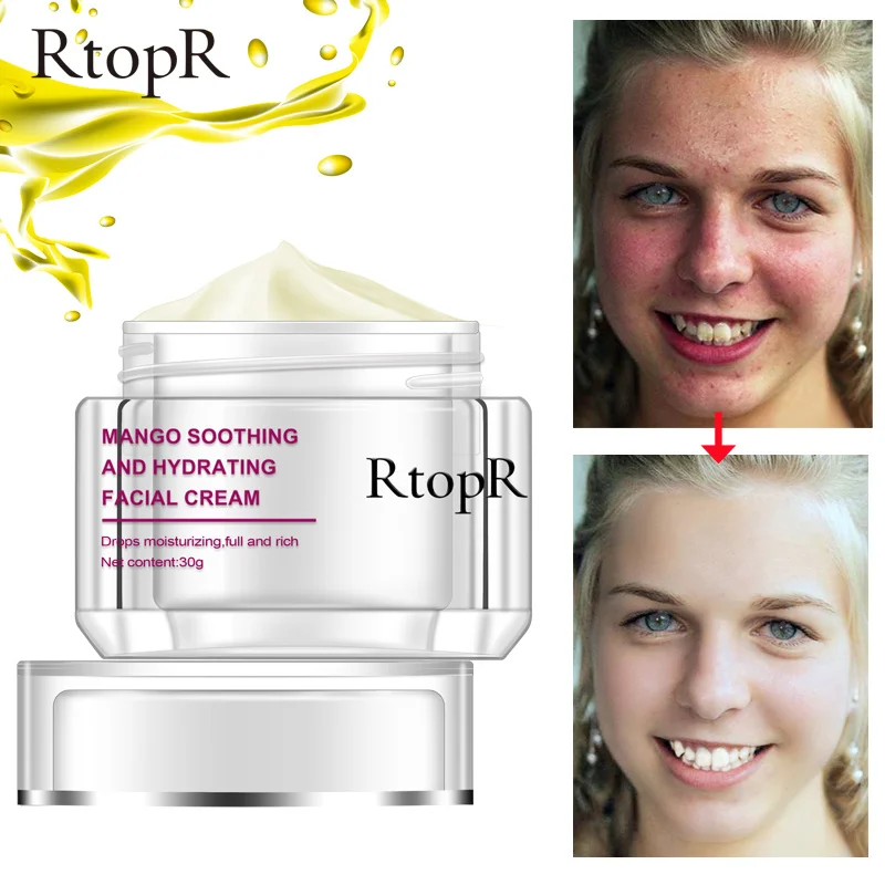 

RtopR Face Cream Anti-Wrinkle Anti Aging Whitening Mango Bright Moisturizing Liquid Tights Nourishing Shrink Pores Care TSLM2