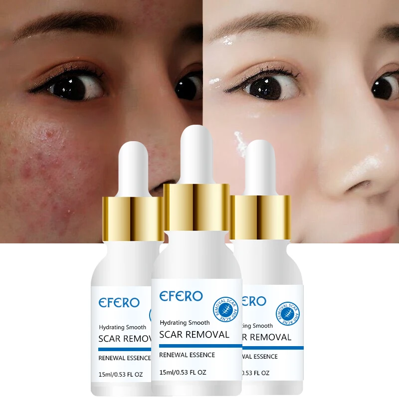 EFERO زيت طبيعي التحكم كريم وجه مصل تبييض ترطيب يتقلص المسام تبييض الوجه العناية بالبشرة المرأة الجمال