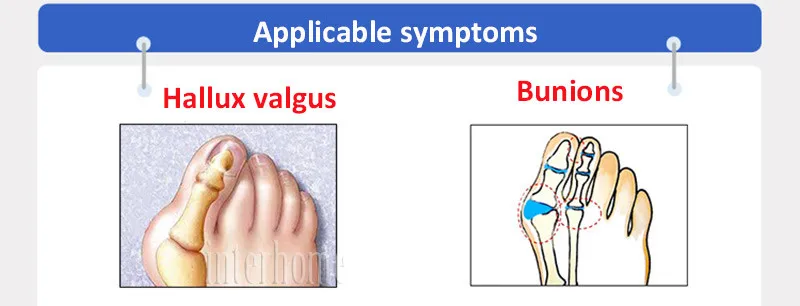 9 шт ноги болеутоляющее носок большой палец носком выправление вальгусной деформации первого пальца стопы разделительный буйон коррекции