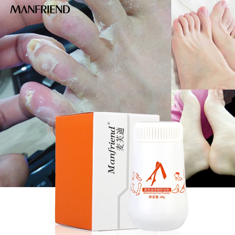 

Foot Plant Herbal Powder Feet Care Absorbs Sweat Whitening Plant Deodorization Antipruritic Both Men And Women Can Use Cream