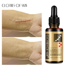 Lavender Remove Scar mark Essence Acne Scar Stretch Marks Hyaluronic acid Skin Repair Product Acne Spots Acne Treatment