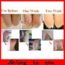 5 пар = 10 шт./лот отшелушивающая маска для ног Уход за ногами маска для ухода за ногами здоровье
