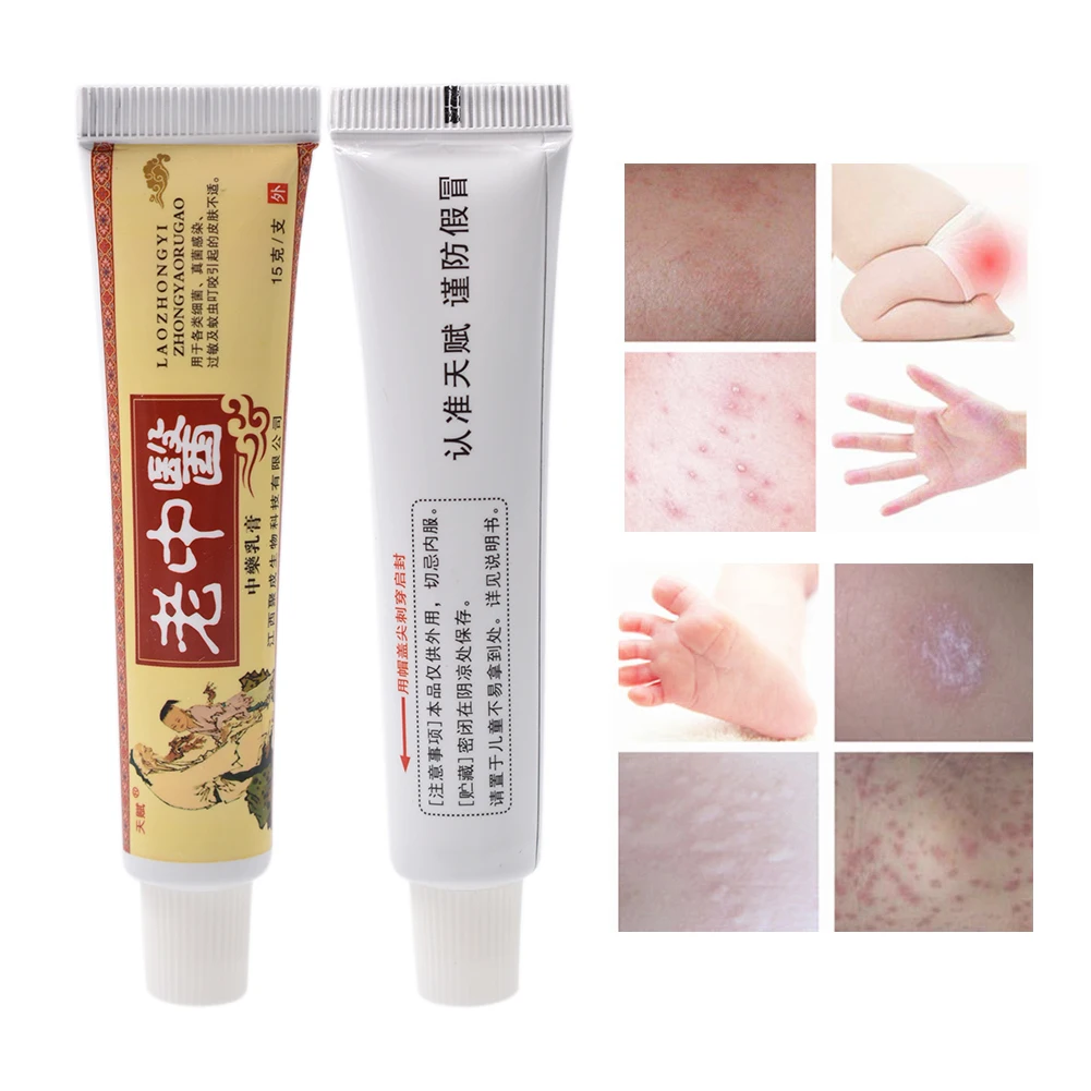 

LaoZhongYi Cream15g Antibacterial and Anti-inflammatory Cream Herbal Relieve Itching Ointment for Psoriasis Eczema Skin Itching
