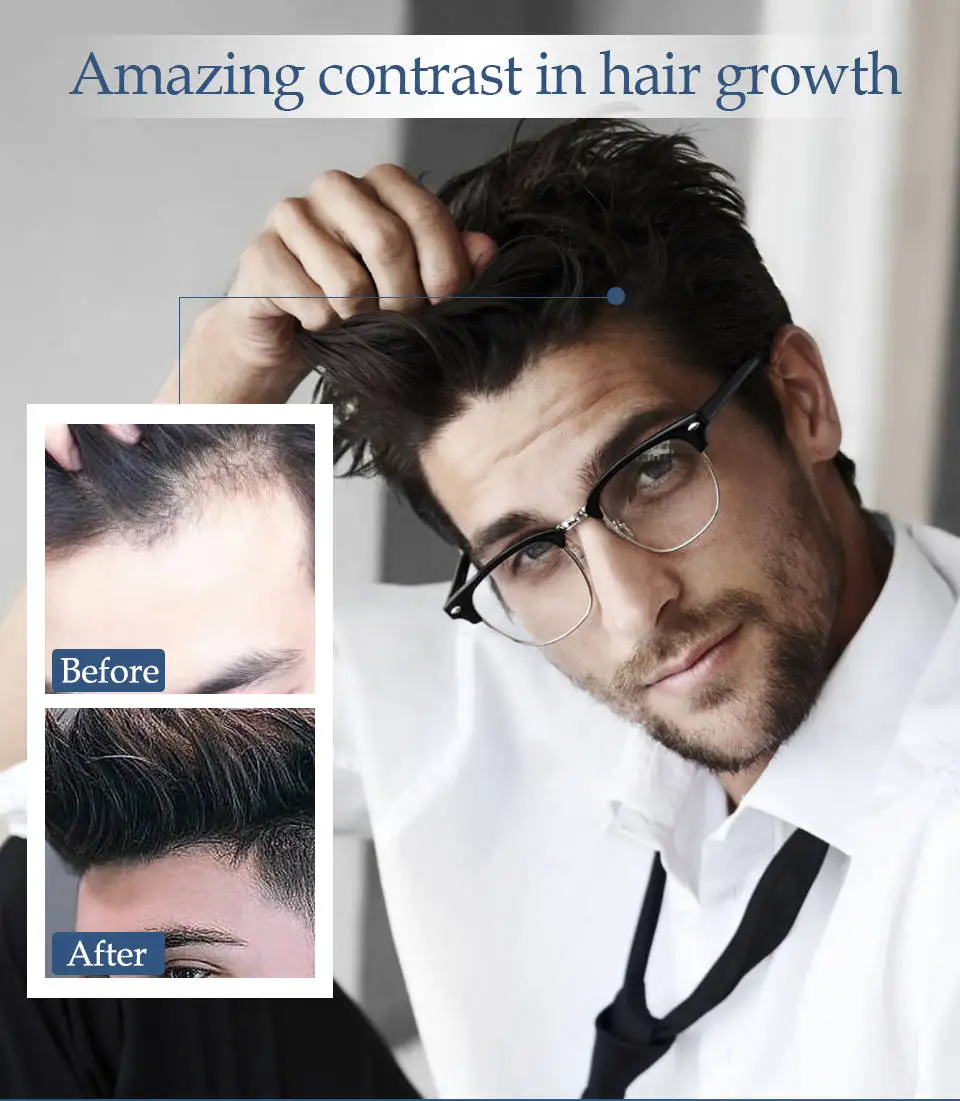 Óleo da Essência do Crescimento do Cabelo Tratamento da Perda de Cabelo para o Reparo do Óleo do Crescimento da Barba Raízes do Cabelo Produtos dos Cuidados com o Cabelo Anti Barba Dano Tônico da 3 High Quality Beleza e saúde