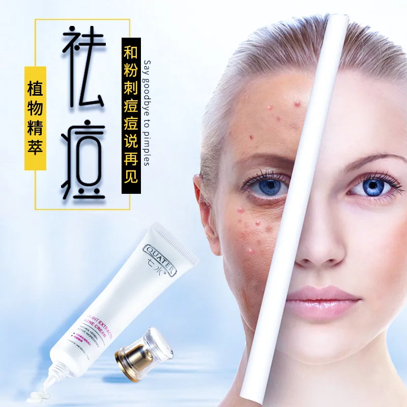 

Skin Care Anti Acne Cream Oil Control Shrink Pores Acne Treatment Scar Remove Removal Gel Cream Whitening Beauty Face Care