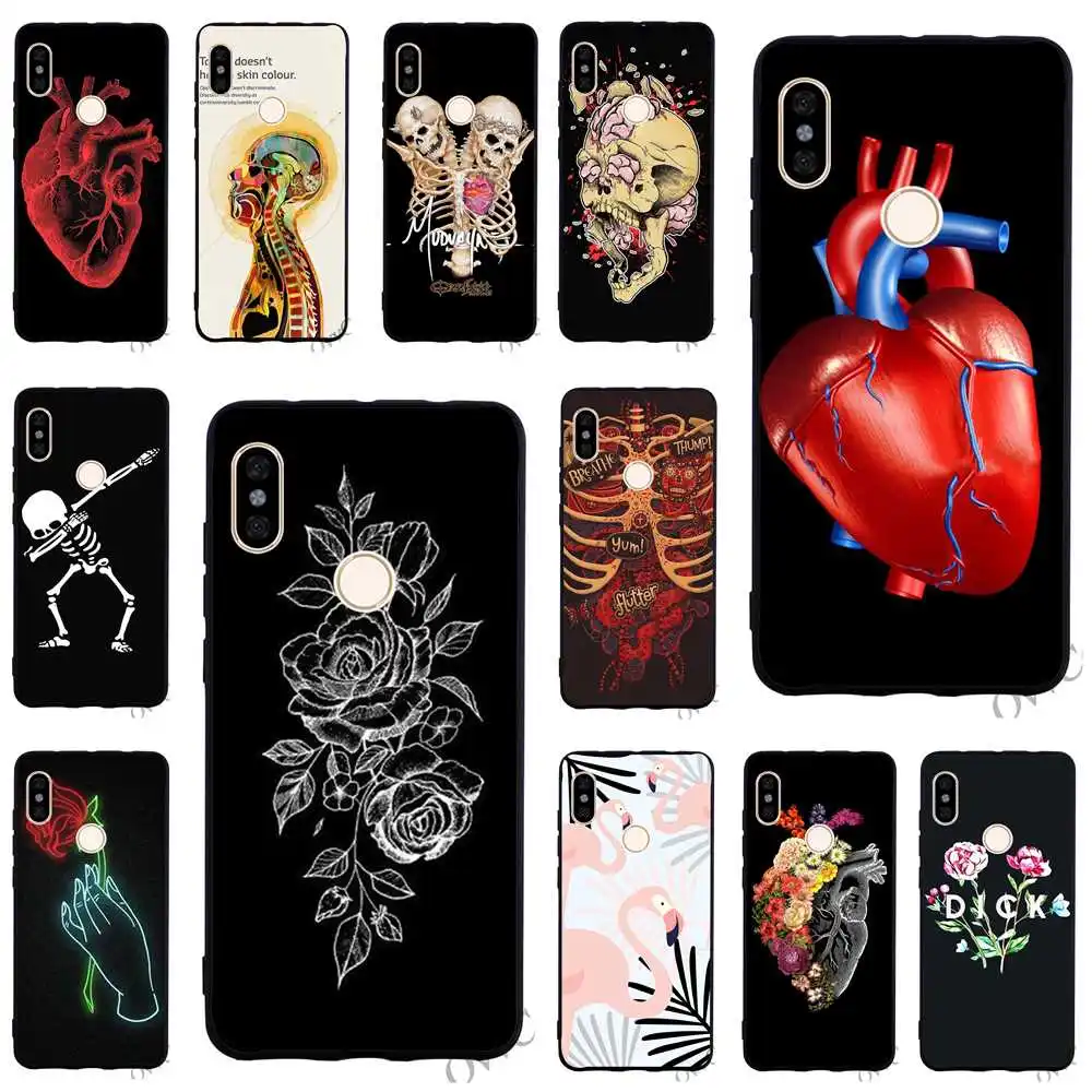 

Pattern Human Anatomy Phone Cover for Xiaomi Redmi 5 Plus Case 4A 4X 5A Prime 6A Note 5 6 Pro TPU Cases Skin