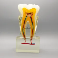 Ортодонтическая модель 6:1 зубы нерв анатомическая разборка демонстрация стоматолога эндодонтика обучение с ясным основанием