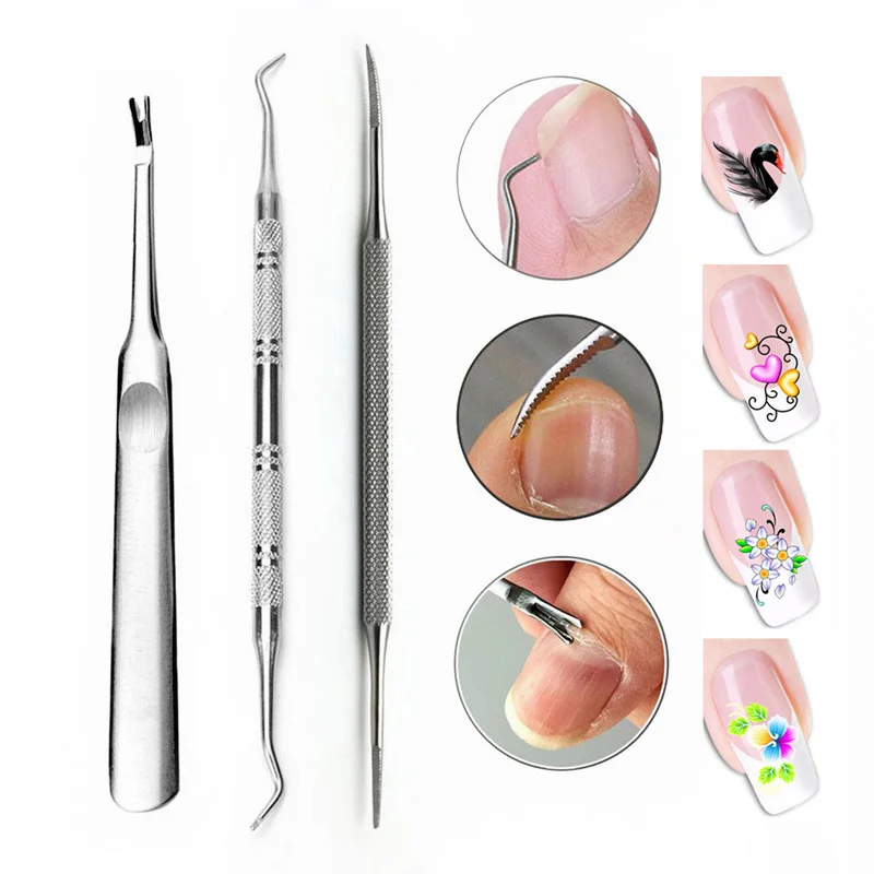 инструмент для вросшего ногтя. инструмент для вросшего ногтя. инструмент для вросшего ногтя. кюретки для вросшего ногтя. инструмент для вросшего ногтя.