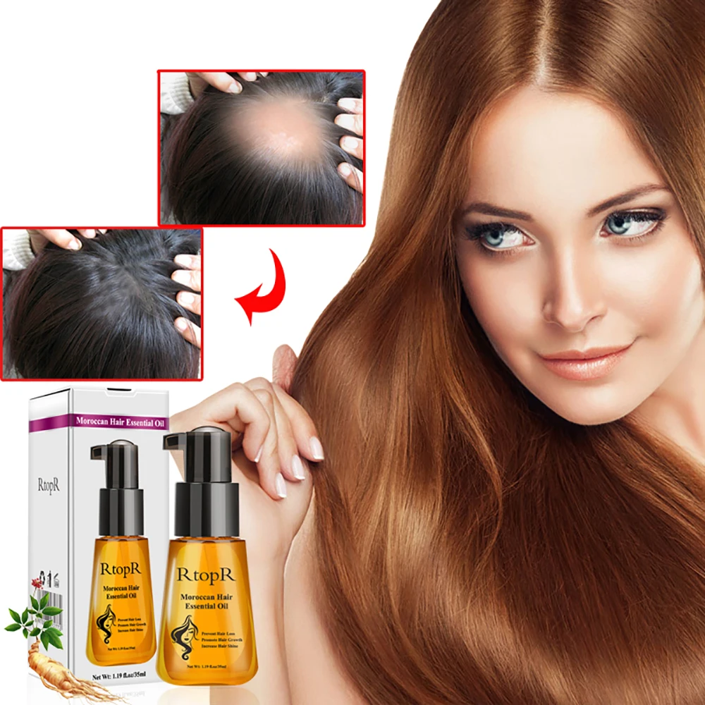 35ml Hair Loss Treatment Ginseng Ginger Hair Growth Oil Herbal For
