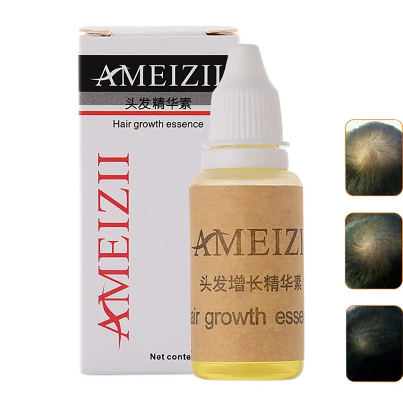 20ml Hair Growth Essence Hair Fast Sunburst Ginger Essence Hair Growth Product Restoration Pilatory