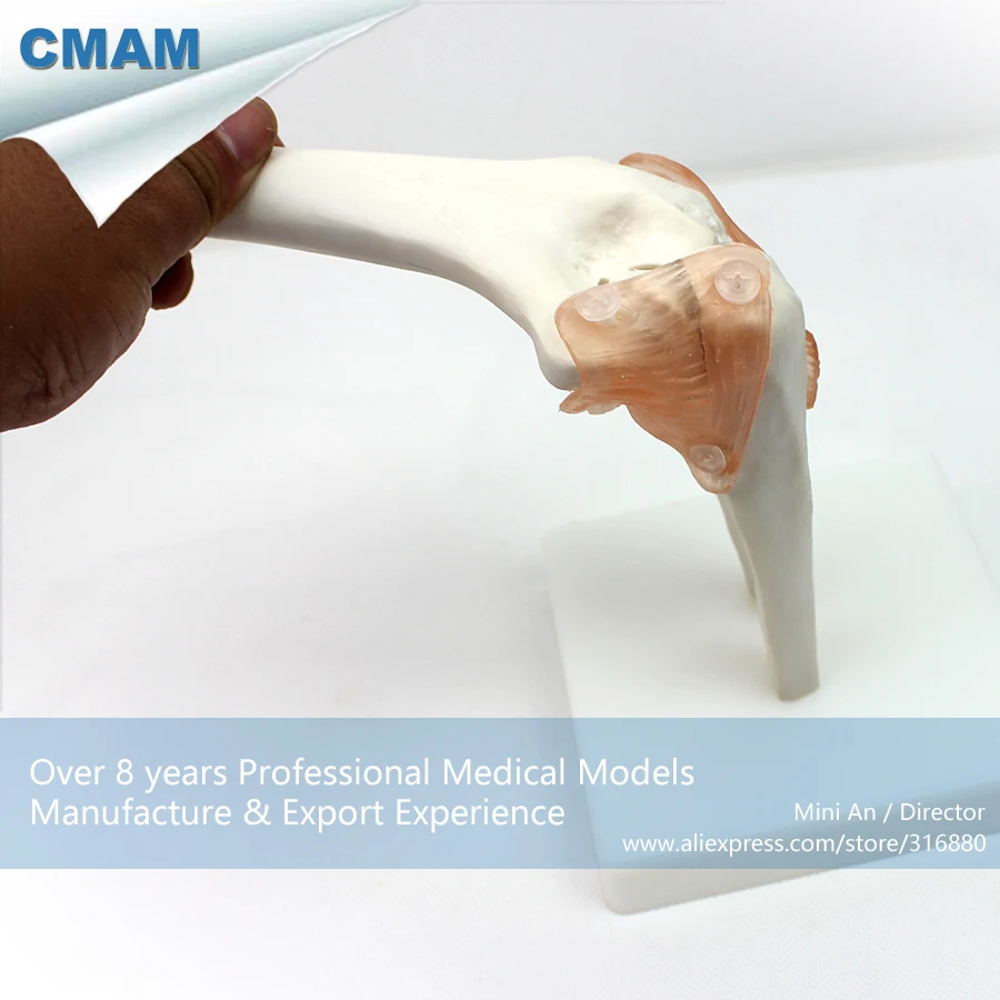 12357 / CMAM JOINT10 Life Size Elbow Joint , Medical Science