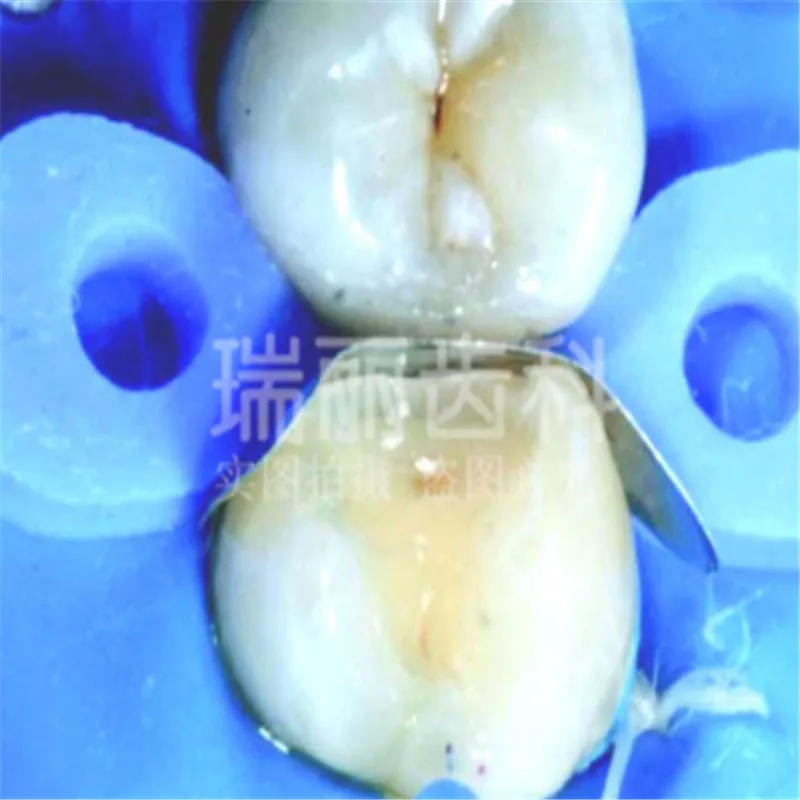 QQ20180315093636