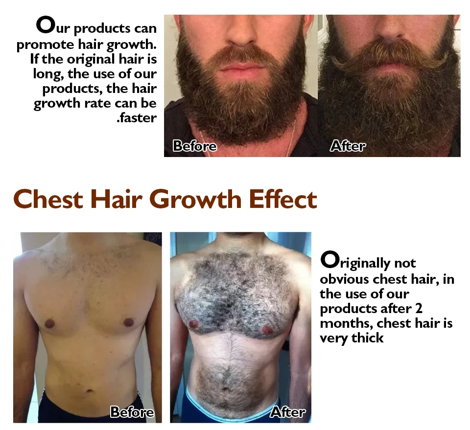 3 шт. эссенция для восстановления роста волос масло для роста бороды против выпадения волос продукты для быстрого роста волос для мужчин и женщин масло для ухода за волосами
