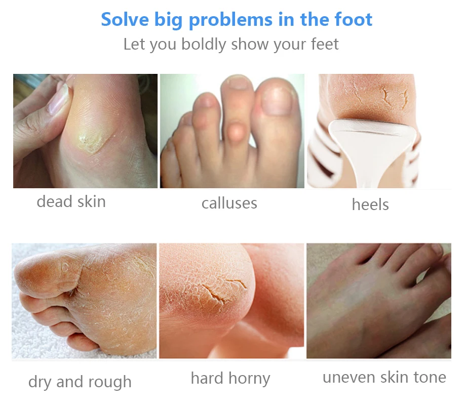 Носки отшелушивающие увлажняющие для ног 12 шт. = 6 упаковок|feet care tool|care toolfeet |