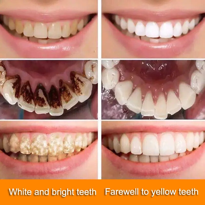 Teeth Whitening Foam Toothpast Oral Care Remove Stain Dental Bleach