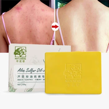 

New 120g Sulfur Soap Oil-Control Bacteriostatic Acne Treatment Blackhead Mite Remover Soap Shrinking Pores Soap Handmade