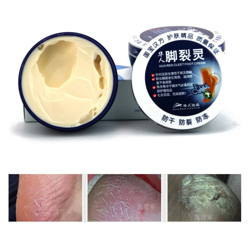 

Winter Repair Chilblain Hand Foot Care Cream Anti Dry Chapping Crack Fissures Heal Exfoliating Ointment Cream Lotions