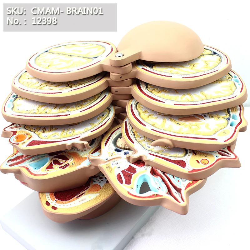 Best Offer #bf010 CMAM12398 Brain, Horizontal Cut, 12pcs Best Offer #bf010 CMAM12398 Brain, Horizontal Cut, 12pcs