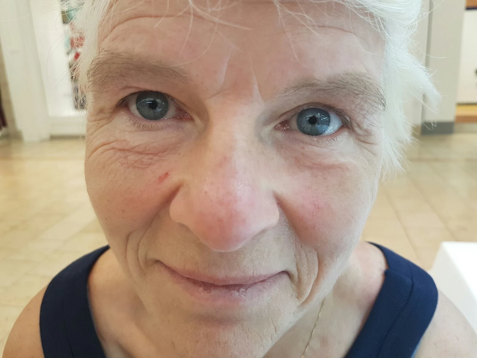 60 SECOND EYE LIFT (1)