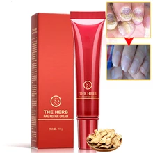 Горячая травяной грибок для ногтей Лечение инструменты для ухода за ногтями ремонт крем для ухода за кожей средство для ногтей