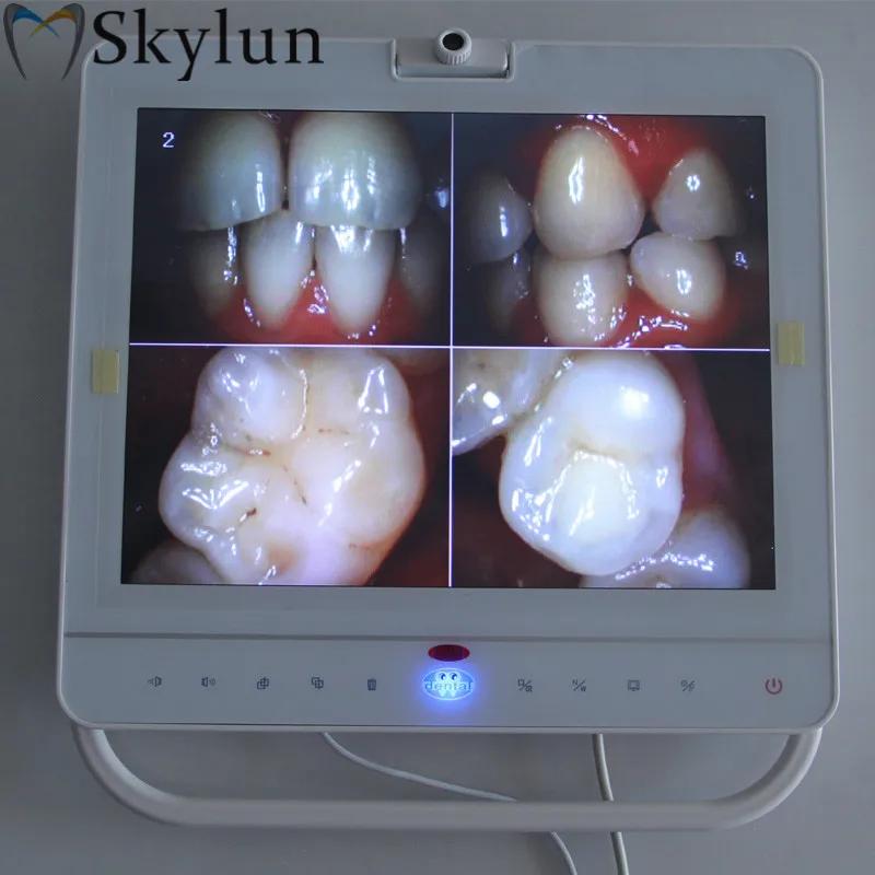 Стоматологическая Система интраоральной камеры с 15 дюймовым монитором проводной/беспроводной внутренний оральный блок VGA+ видео+ USB ЖК-держатель эндоскоп TW123