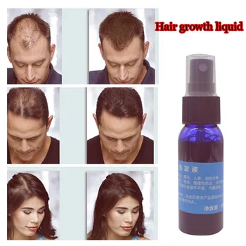 

new brand Okeny's 2016 yuda pilatory hair growth Product Liquid Fast Hair Growth hair loss Treatment 30ml/bottle anti gray hair