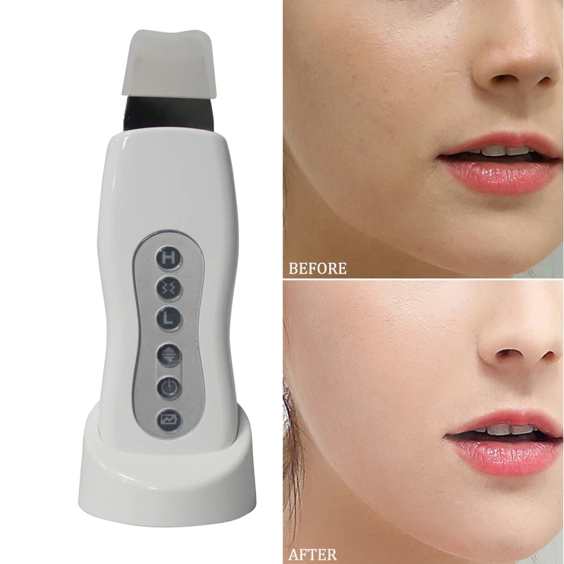 Ultrasonic Skin Cleaner Cleaning Acne Removal Face Care Tool Skin High
