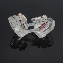 Стоматологическая Ортодонтическая модель модели неправильного прикуса обучающая модель прозрачная для стоматологической лаборатории