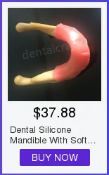 Alta Qualidade Dental Typodon Dentes Modelo - Ortodôntico Steelteeth M8017 31 Alta qualidade dental m8017 typodon dentes modelo ortodôntico steelteeth modelo
