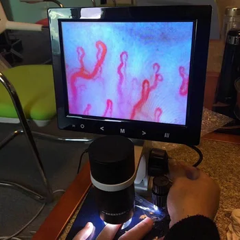 

Clinic use 8 Inch Nailfold Capillaroscopy capilar health care diagnosis hyperthyroidism microcirculation of Nail Wall Observer