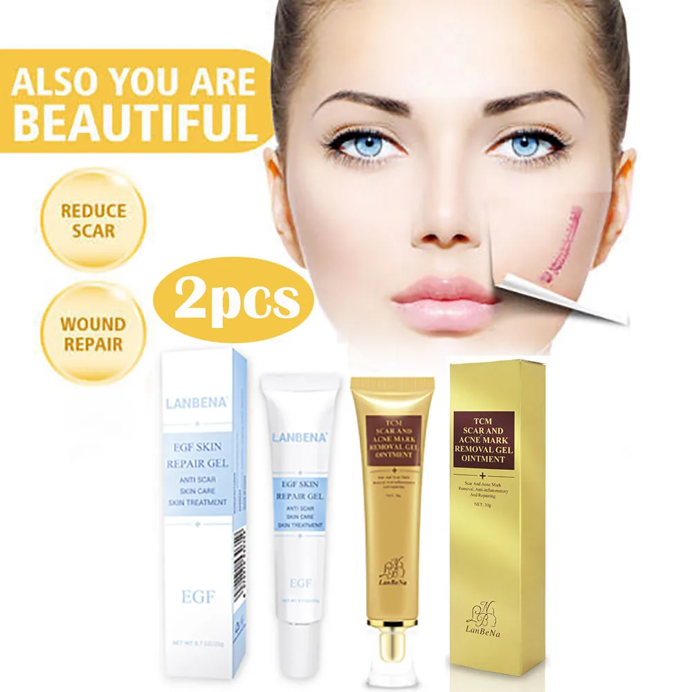 mark removal cream for skin