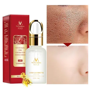 

MeiYanQiong Centella Asiatica Acne Treatment Eliminate Acne Removing Serum Moisturizing Oil Control Whitening Repair