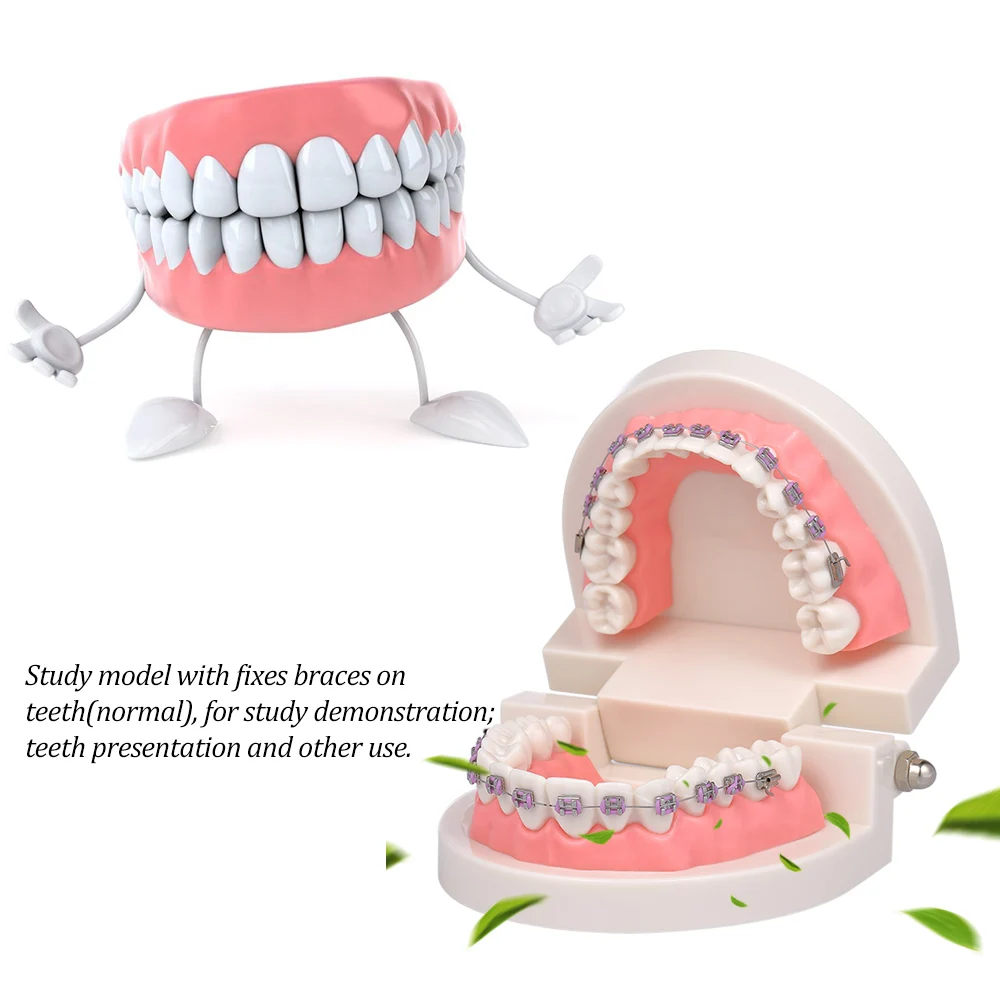 Стоматологическая Ортодонтическая модель Mallocclusion с кронштейнами Archwire Buccal модель зубов пробки для общения пациента обучения взрослых