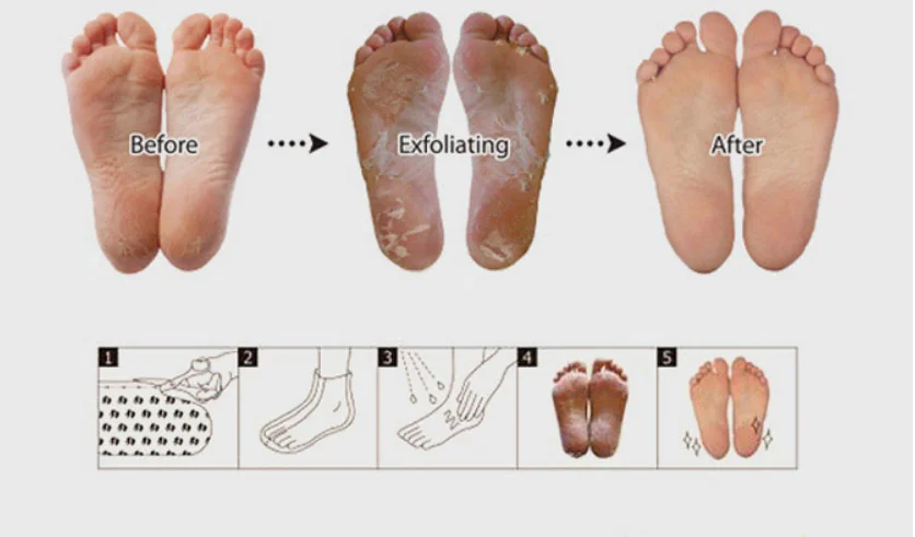 5 пар пилинг для ног отшелушивающая маска для ног ребенка для удаления мозолей, роговой слой, чтобы показать вашу красоту ног