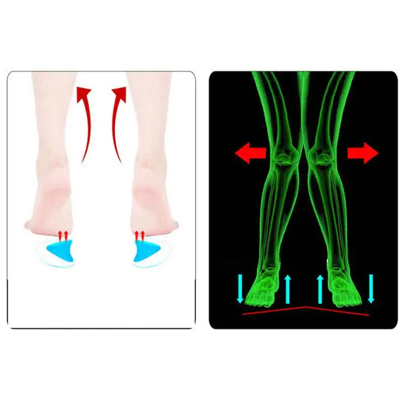 1pair=2pc Silicone Shoe Pads Orthopedic Adjuster Arch Support Orthotic Insole Flat Foot Flatfoot Corrector Cushion Pad Foot Care