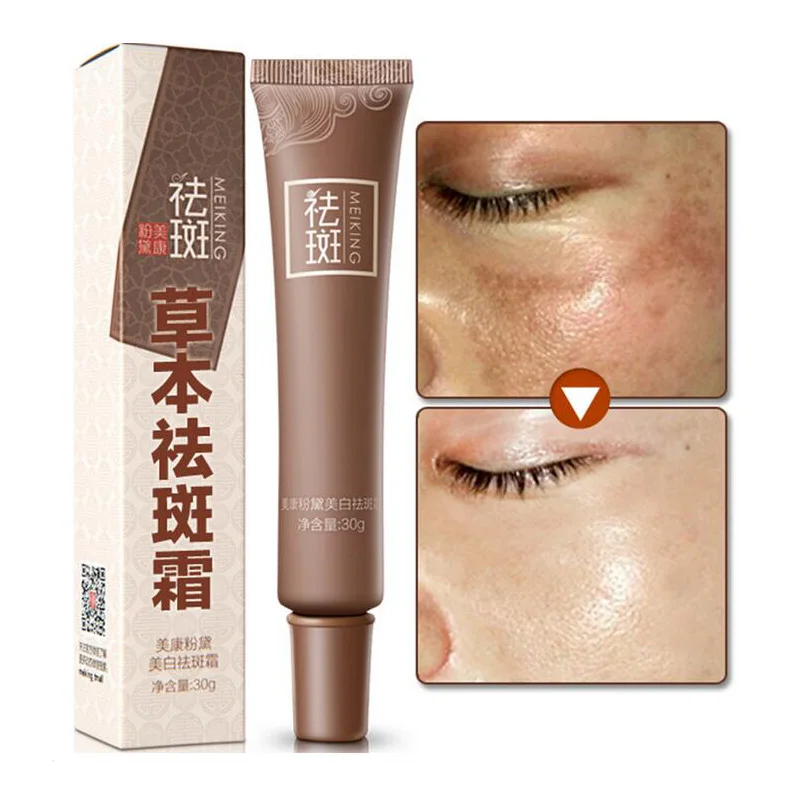 

Dark Spot Corrector Skin Whitening Fade Cream Lightening Blemish Removal Serum Reduces Age Spots Freckles Melasma Face Cream