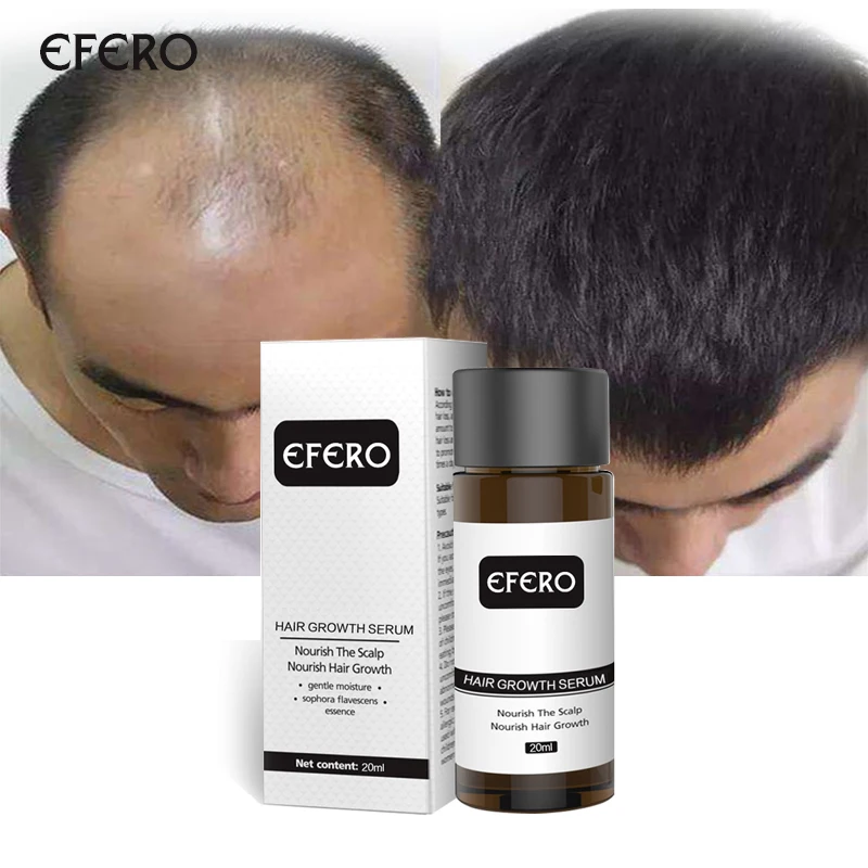 Натуральный имбирь эссенция для роста волос предотвращает выпадение волос мощная Сыворотка для ухода за волосами эфирное масло гуще предотвращает облысение продукты